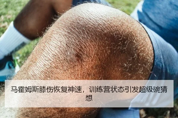 马霍姆斯膝伤恢复神速，训练营状态引发超级碗猜想